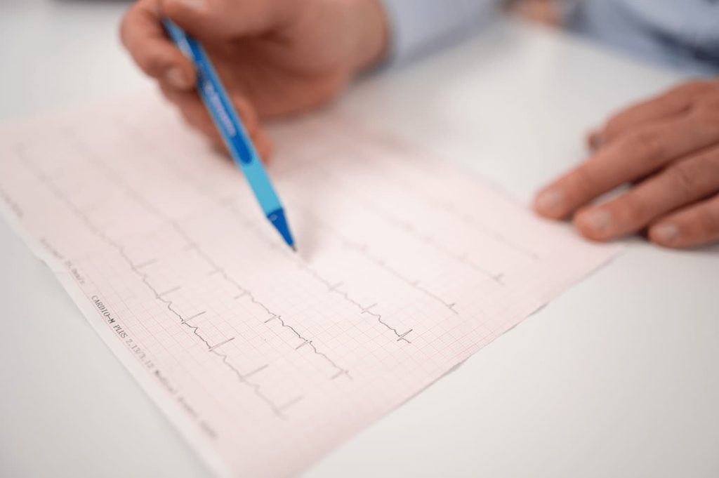 Blick auf ein EKG mit dem Stift in der Hand