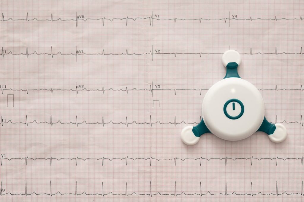 Bild von einem EKG